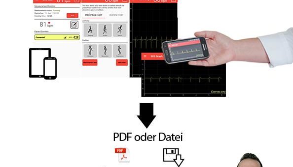 Savvy PCARD erlaubt ununterbrochene kabellose EKG-Überwachung