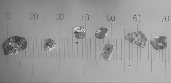 Lucapa Diamond: Kursexplosion nach spektakulären Bohrergebnissen