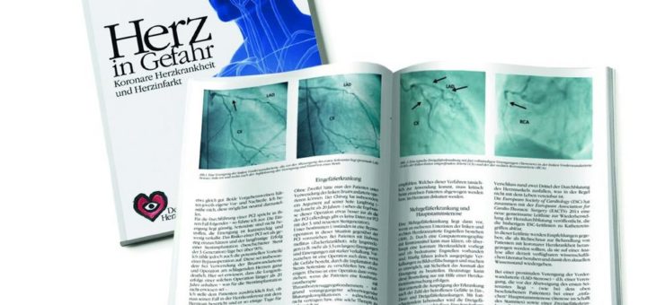Herzkrank in die Sauna: Was geht und was ist tabu?