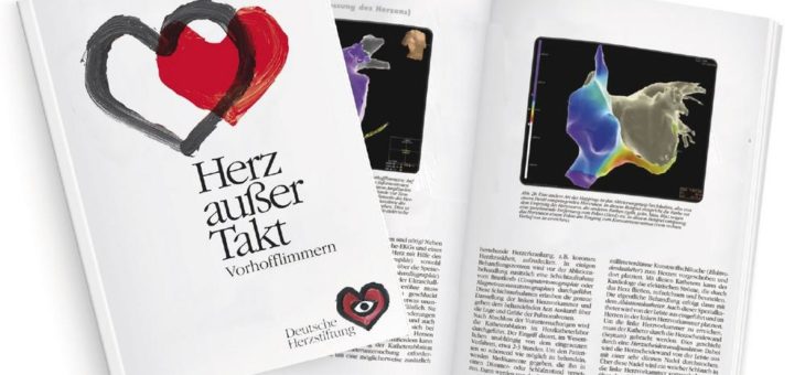 Vorhofflimmern: Operation steht an – wann Gerinnungshemmer wegen Blutungsrisiko absetzen?