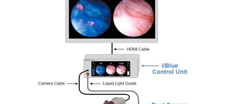 Imagin Medical erreicht Meilenstein bei neuer Bildgebung für Blasenkrebs