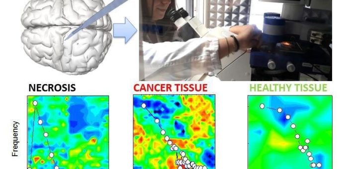 Untersuchungen zur Biomechanik der Zelle mit JPKs NanoWizard®- und CellHesion®-Rasterkraftmikroskopen an der Katholischen Universität Rom