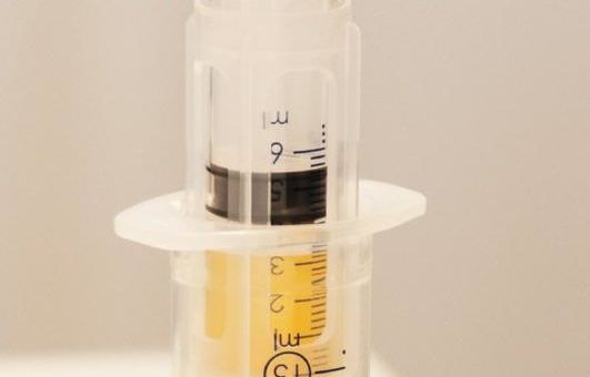 Therapie mit Eigenblut-Plasma: „PRP“ – die sanfte Revolution in der Orthopädie und Unfallchirurgie