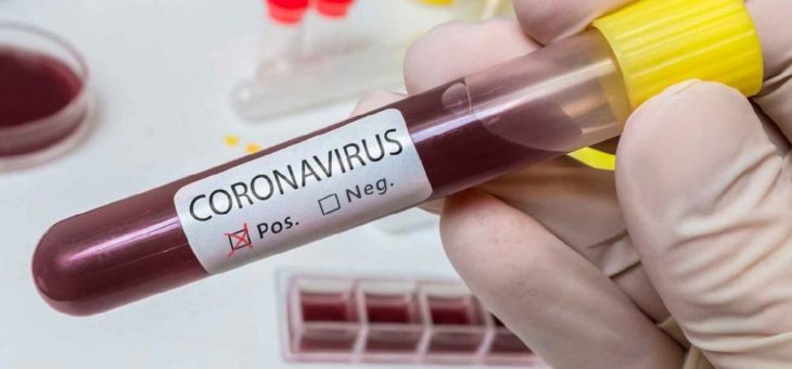 Coronavirus – Die wichtigsten Fragen und Antworten für Arbeitgeber und Arbeitnehmer