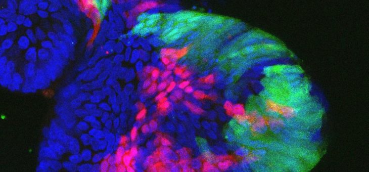 Mit Mini-Därmen funktionelle Unterschiede und Schwachstellen von Darmkrebs aufspüren