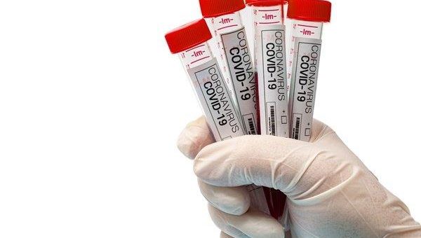 ViraxClear meldet Vertriebsvereinbarung für COVID-Schnelltest in Asien