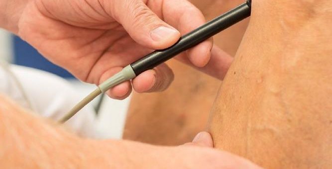 Thrombosen – erste Anzeichen ernst nehmen