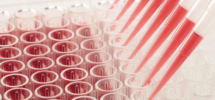 Verlässliche Antikörpertests für die COVID-19 Diagnostik – die beiden Biotechnologieunternehmen CANDOR Bioscience GmbH und trenzyme GmbH leisten mit ihren Produkten einen wichtigen Beitrag für die COVID-19 Test-Entwicklung