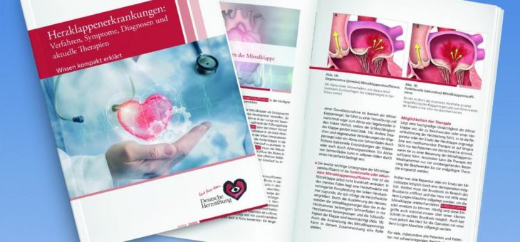 Operativer Herzklappenersatz: Maßgeschneiderte Aortenklappe aus eigenem Herzgewebe