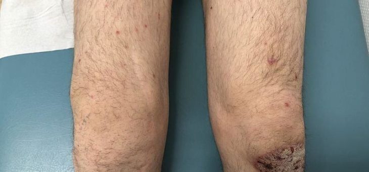 Dermatologie und Rheumatologie starten gemeinsame Sprechstunde