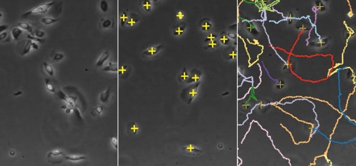 Sparen Sie Zeit: Automatische Analyse von Chemotaxis-Assays