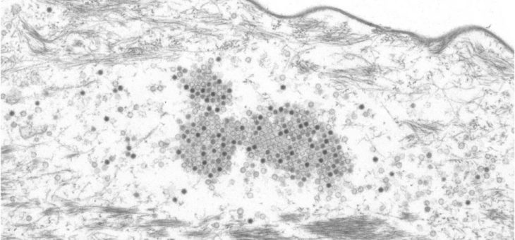 Falsche Fährte: Wie Papillomviren das Immunsystem austricksen