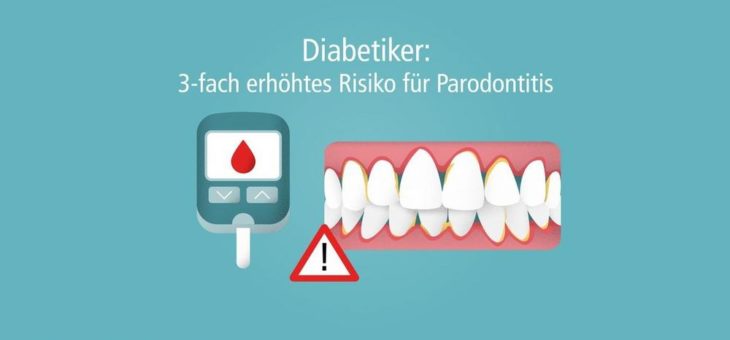 Am 14.11. ist Weltdiabetestag: Diabetes und Parodontitis sind ein gefährliches Duo!