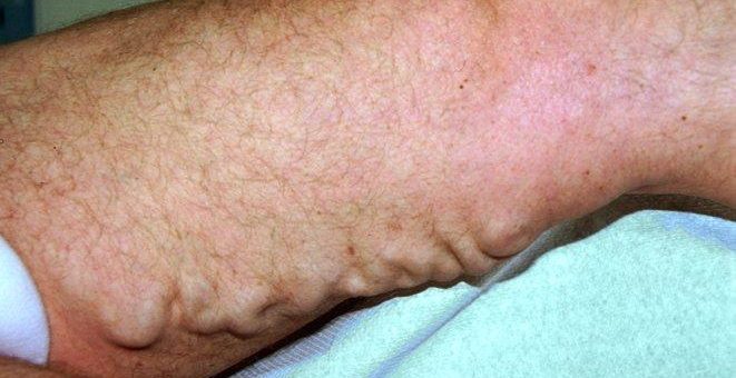 Hightech-Medizin für Männerbeine
