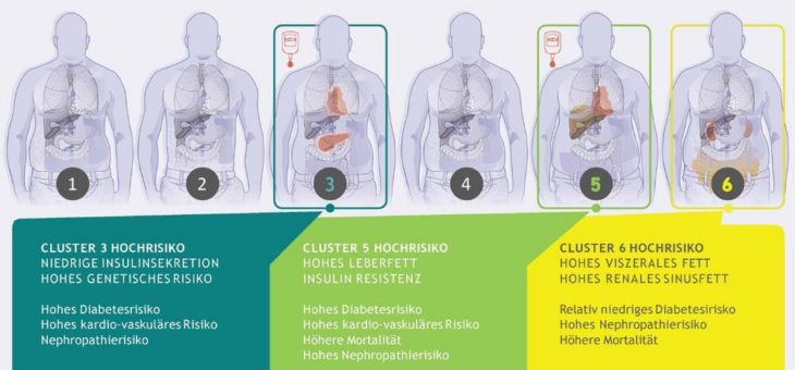 Subtypen bei Vorstufe des Diabetes entdeckt