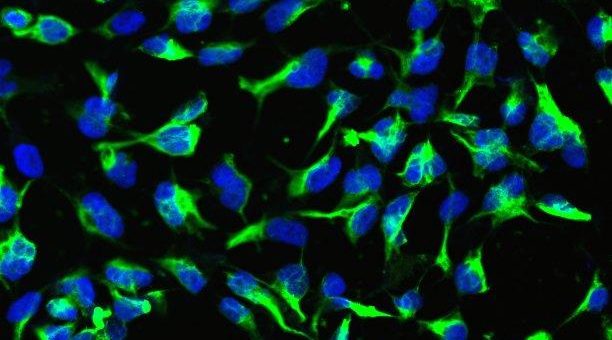 Folgenreicher Fehler: Neurale Stammzellen werden durch epigenetische Reprogrammierung zu Treibern kindlicher Hirntumoren