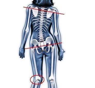 Aktionstag „Körper-Scan“: Schmerzen zuordnen, Symptome deuten