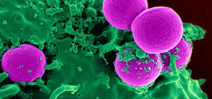 Gefährliche Bakterien mit Nanopartikeln auflösen