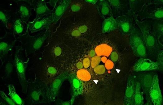 Messen, was verbindet – Gewebeschäden durch Zellfusion in COVID-19 und die Rolle des Spikeproteins