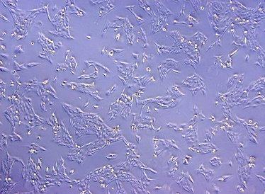 Was fördert die Aggressivität kindlicher Neuroblastome?