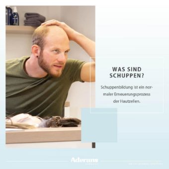 Was sind Schuppen?