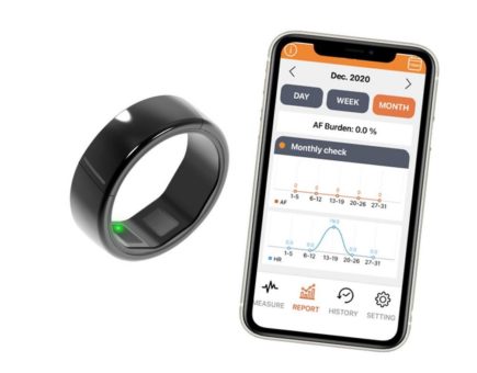 CART-I von Skylabs – mobiler EKG-Ring zur permanenten Herzüberwachung – Medizinprodukt jetzt in Deutschland erhältlich