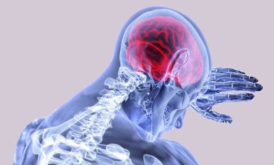 Bis zu 90% der Schlaganfälle durch gesunden Lebensstil vermeidbar