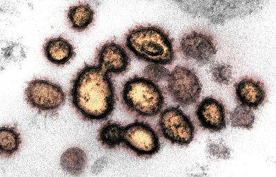 Adventistische Kirchenleitung zum Umgang mit dem Coronavirus