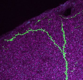 Welt-Alzheimer-Tag: Demenz – genau hinsehen!