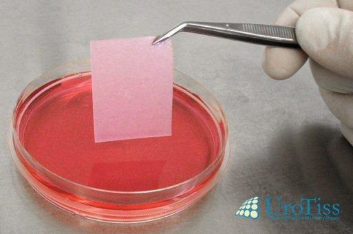 UroTiss Europe GmbH wird für Kommerzialisierung des Zelltherapeutikums MukoCell® von EU gefördert
