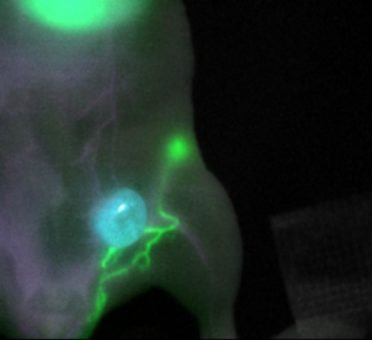 Durchbruch bei Farbstoffentwicklung für die fluoreszenzgeführte Krebschirurgie