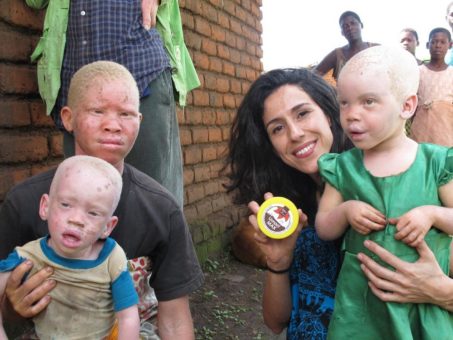 BASF und Beyond Suncare stärken ihre Zusammenarbeit zum Schutz von Menschen mit Albinismus in Afrika