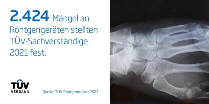 Neuer TÜV-Report zeigt Mängel an Röntgengeräten in Kliniken und Arztpraxen