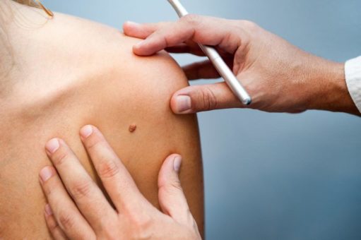 Helios: Dermatologie als Hauttumorzentrum zertifiziert