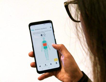 HanseMerkur bietet digitale Hilfe für Neurodermitis-Betroffene