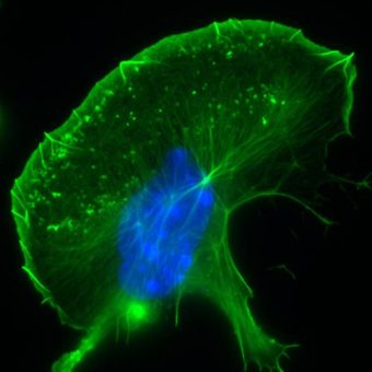 Aufbau des Zellskeletts: Molekulare Wirkmechanismen zentraler Signalgeber aufgeklärt
