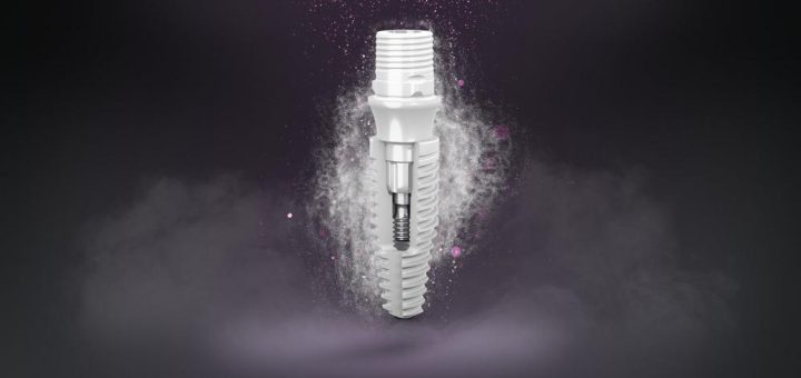 Das innovative Zi Ceramic Implant System für Sofortversorgungen