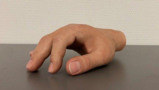 Forum Medizin zur Rapid.Tech 3D zeigt: Immer mehr additiv hergestellte Produkte erfüllen die hohen medizinischen Standards
