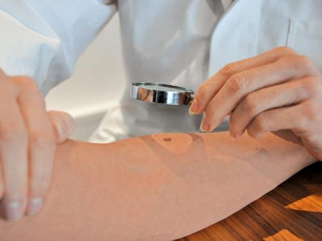TÜV Rheinland: Bei Hautproblemen im Beruf rechtzeitig entgegensteuern