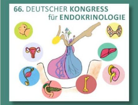 Diabetes beginnt im Gehirn – Neuste Forschungserkenntnisse beim DGE-Kongress