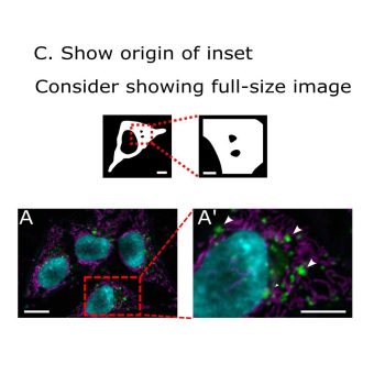 Weltweiter Standard soll Qualität mikroskopischer Bilder in wissenschaftlichen Publikationen verbessern