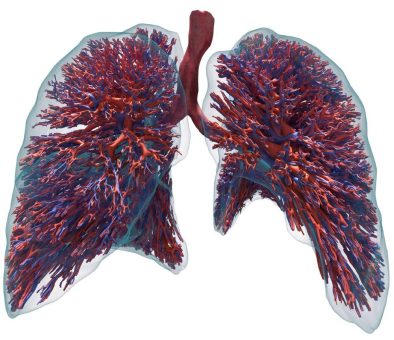 Innovatives Forschungsprojekt am UKSH: Virtueller Lungenzwilling soll mittels KI Vorhersage von Therapieerfolgen ermöglichen