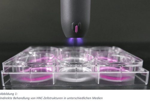 Plasma-Onkologie: Adjuvante Therapie von Kopf- und Hals-Krebs mit kalt-atmosphärischem Plasma