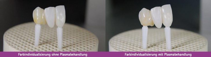 Messevorschau IDS – Plasma-Handgerät für das Dentallabor und Plasma-Komponenten zur Systemintegration