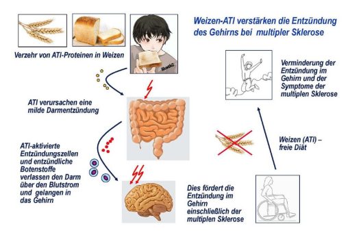 Ernährung als Risikofaktor der Multiplen Sklerose