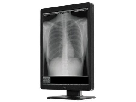 Display für die Röntgen- und Mammografiediagnostik