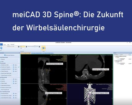 mediCAD® 3D Spine