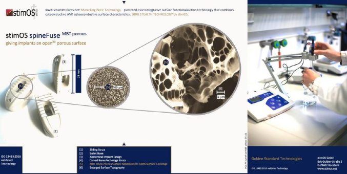 Deutsches Medizintechnik-Start-up stimOS setzt neue Maßstäbe bei Implantatoberflächen und Beschichtungstechnologien