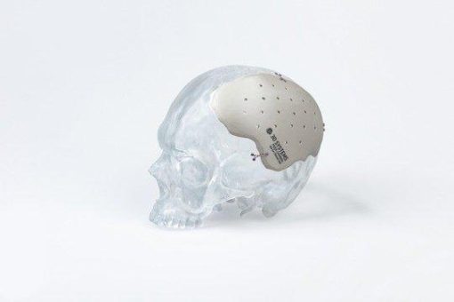 3D-Druck in der Medizin – ein gesunder Weg