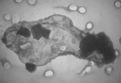 Elefant im Raum – Ultrafeine Partikel und anthropogene organische Aerosole